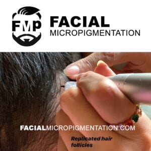 Facial micropigmenation